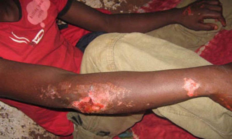 Rdc-Angola : Quatre congolais meurent dans un cachot cabindais