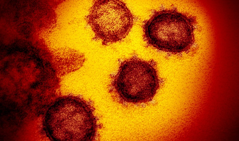 Matadi: »le chinois arrivé à DIHAO n’a pas le Coronavirus »