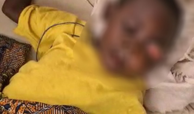 SOS pour un enfant de Matadi qui souffre énormément d’un œil qui sort de son orbite