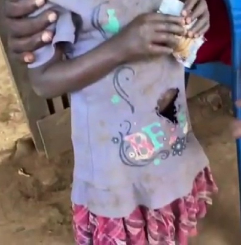 Déféquer par son organe génital : la dure réalité d’une enfant de Lukula, au Kongo central